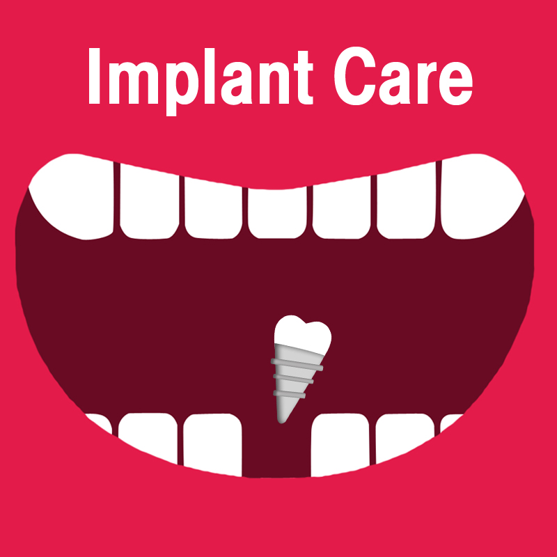 Implant Care